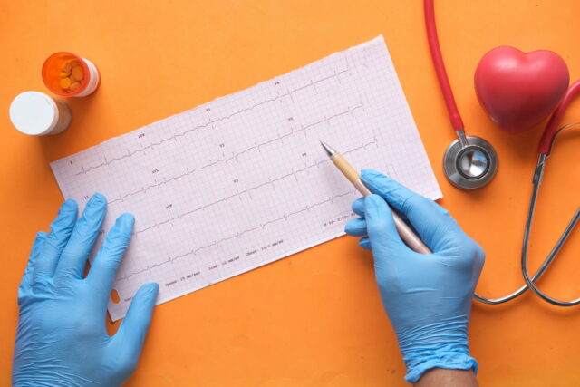 Cardiac investigations